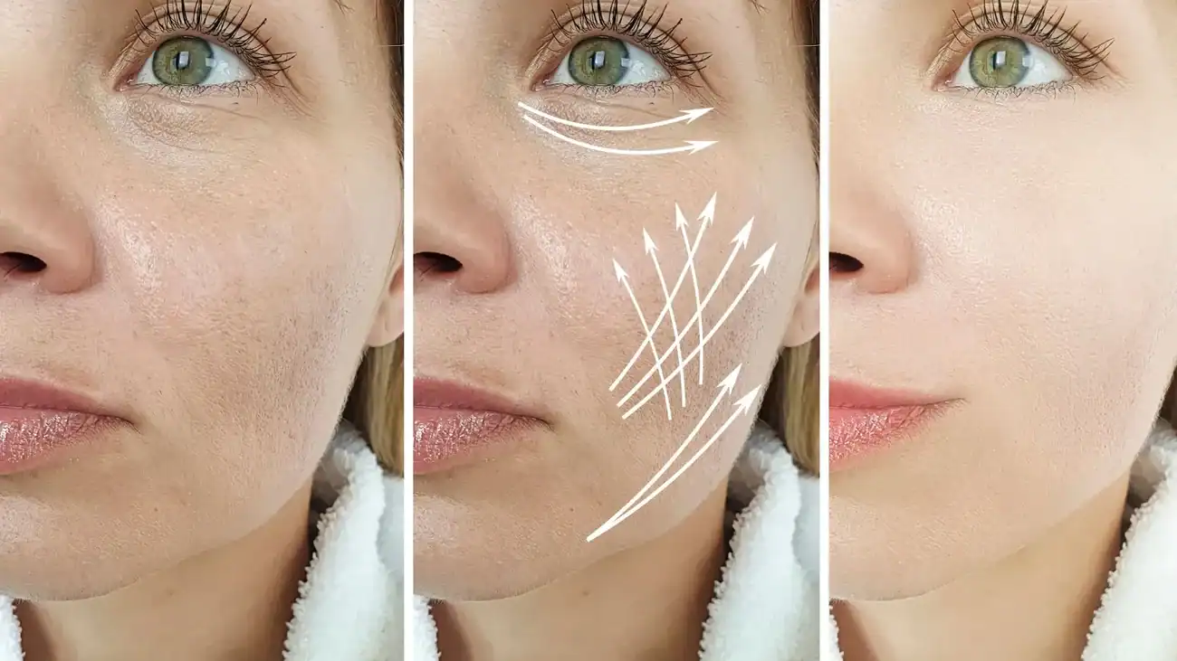 Can One Treatment Really Tackle More Than One Skin Concern Stansted?
