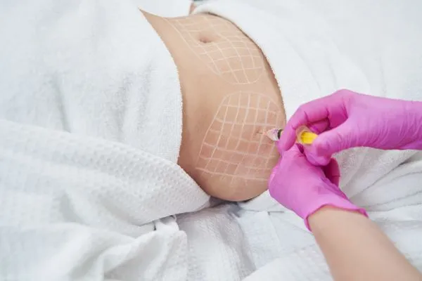 image of fat dissolving injections on love handles to help combat weight gain Stansted