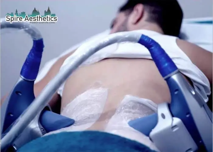 Man having fat freezing treatment done on love handles before a competitions Stansted to create a sculpted look.