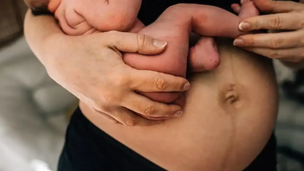 Why Is My Stomach Still Big After Pregnancy Stansted?